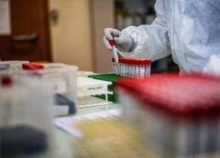 Covid, l'Aspirina frena l'attacco del virus e limita il danno ai polmoni: l'ultimo studio