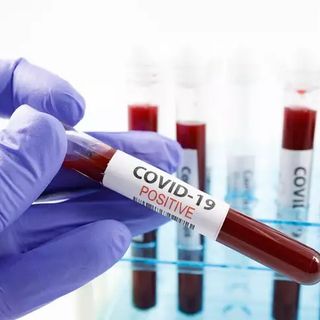 coronavirus - foto di repertorio
