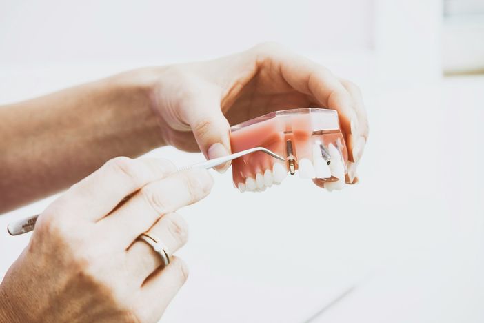 Scelta del dentista: 7 consigli che fanno la differenza Scelta del dentista: 7 consigli che fanno la differenza