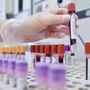 Dal microbiota una speranza contro l'epilessia resistente, lo studio italiano Dal microbiota una speranza contro l'epilessia resistente, lo studio italiano