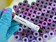 Coronavirus, 71 i decessi comunicati oggi. Sfiorano quota 3000 i pazienti guariti