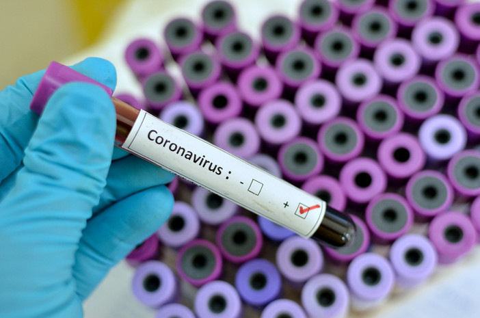 coronavirus - foto di repertorio