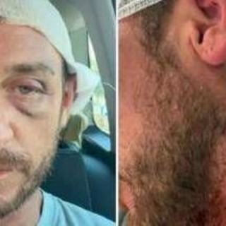 "Io aggredito a sassate in Sardegna da 30 persone perché gay", la denuncia sui social ﻿