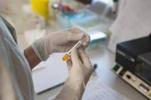 Cancro prostata metastatico ormonosensibile, nuovi dati su darolutamide mostrano benefici in sopravvivenza Cancro prostata metastatico ormonosensibile, nuovi dati su darolutamide mostrano benefici in sopravvivenza