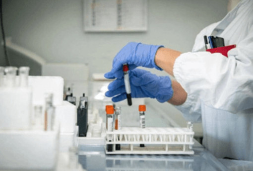 Alzheimer, allo studio nuovo test del sangue per diagnosi precoce