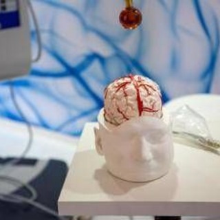 Dai gliomi al Parkinson, così l’intelligenza artificiale aiuta la Neurochirurgia Dai gliomi al Parkinson, così l’intelligenza artificiale aiuta la Neurochirurgia