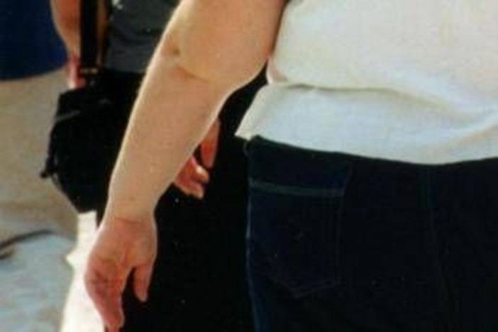 Una morte per malattie infettive su 10 è legata all'obesità, lo studio