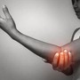 Malattie reumatologiche e osteoporosi, Ucb: "Trasformare la ricerca in cure accessibili"