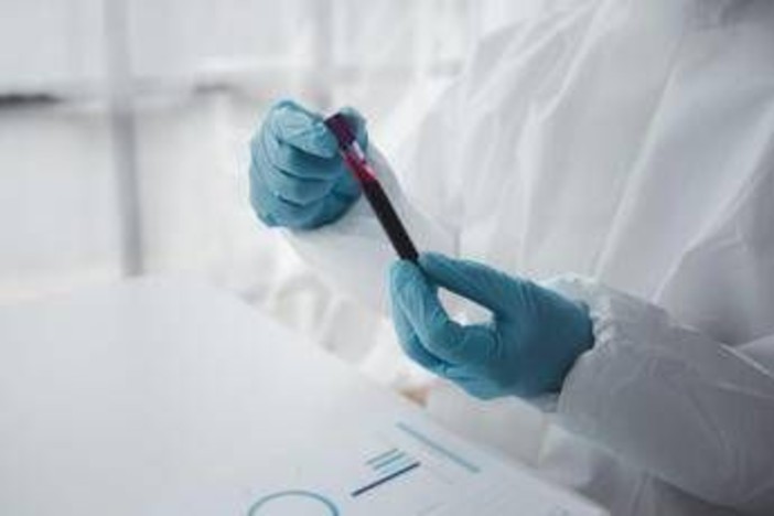 Epatite A in forte crescita in Italia: Lazio, Campania e Puglia le regioni con più casi Epatite A in forte crescita in Italia: Lazio, Campania e Puglia le regioni con più casi