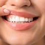 Denti a rischio tra i giovani, Sidp: "Il 36% della Gen Z ha gengive che sanguinano"