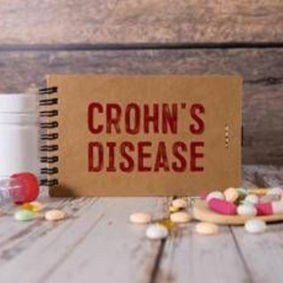 Malattia Crohn con fistole, nuovi dati su terapia monoclonale
