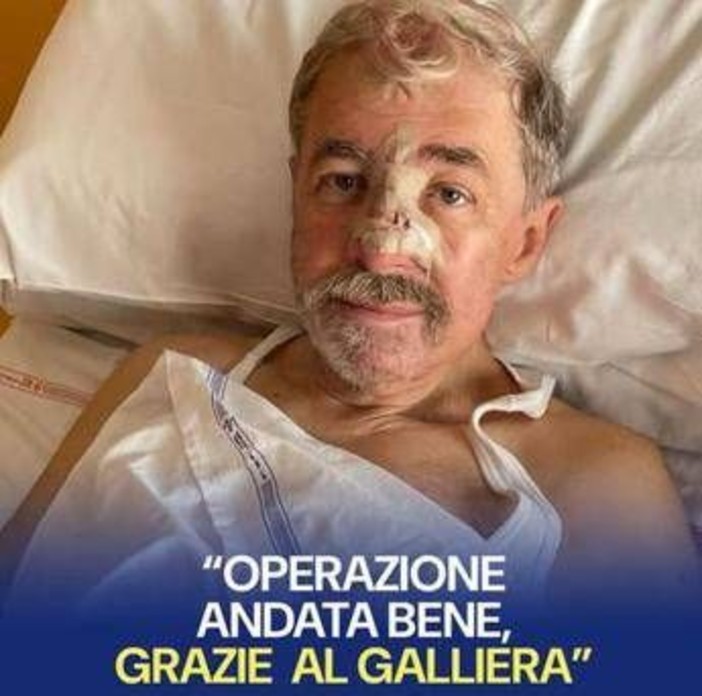Marco Bucci operato al Galliera per la ricostruzione cutanea al naso: "Sto bene"