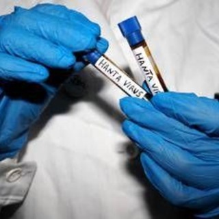 Hantavirus, l'Oms avverte: è più contagioso non appena compaiono i sintomi