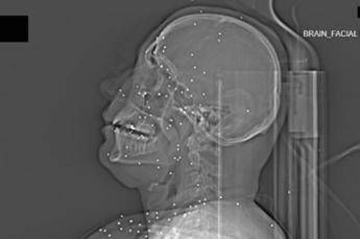 L'inchiesta horror sulle violenze iraniane: 'Manifestanti uccisi e colpiti nelle parti vitali' L'inchiesta horror sulle violenze iraniane: 'Manifestanti uccisi e colpiti nelle parti vitali'